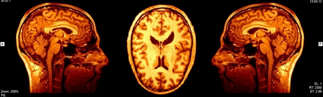 What is cognitive science?